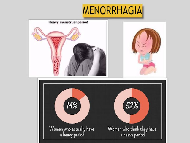 HOW TO TREAT MENORRHAGIA