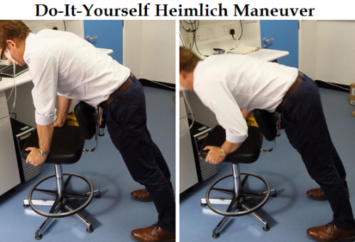 Heimlich maneuver